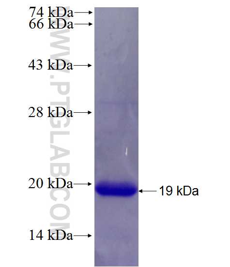 TMX1 fusion protein Ag26656 SDS-PAGE