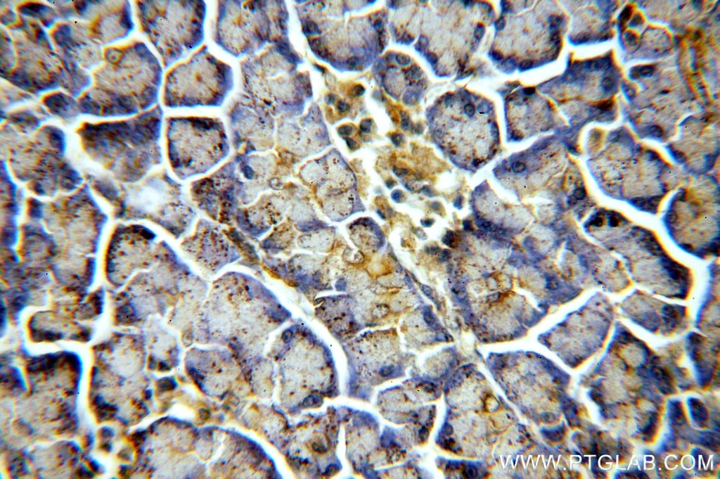 Immunohistochemistry (IHC) staining of human pancreas tissue using TMX2 Polyclonal antibody (19838-1-AP)