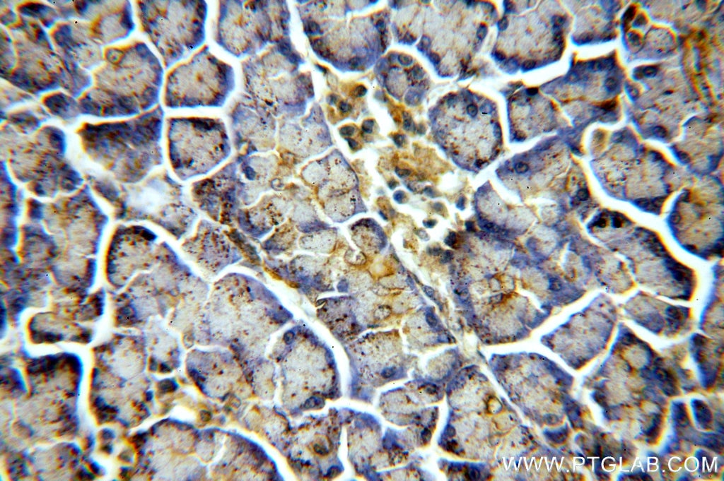 IHC staining of human pancreas using 19838-1-AP