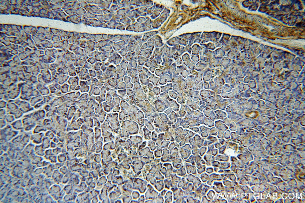 Immunohistochemistry (IHC) staining of human pancreas tissue using TMX2 Polyclonal antibody (19838-1-AP)