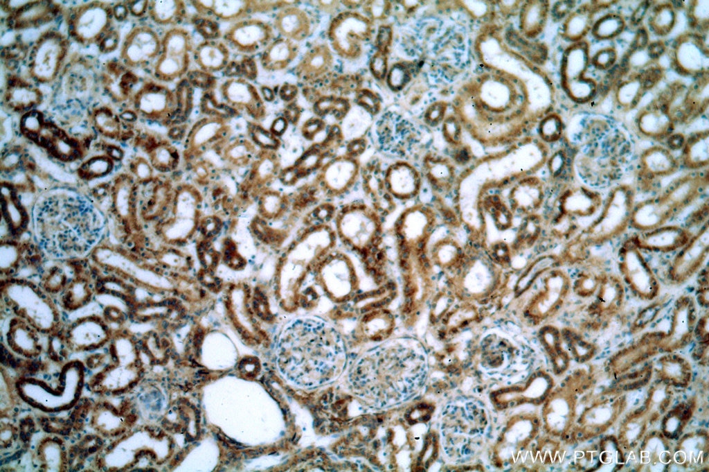 Immunohistochemistry (IHC) staining of human kidney tissue using TMX2 Polyclonal antibody (19838-1-AP)