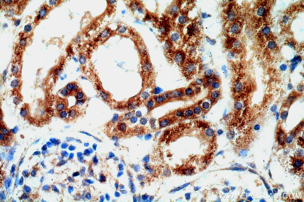 Immunohistochemistry (IHC) staining of human kidney tissue using TMX2 Polyclonal antibody (19838-1-AP)