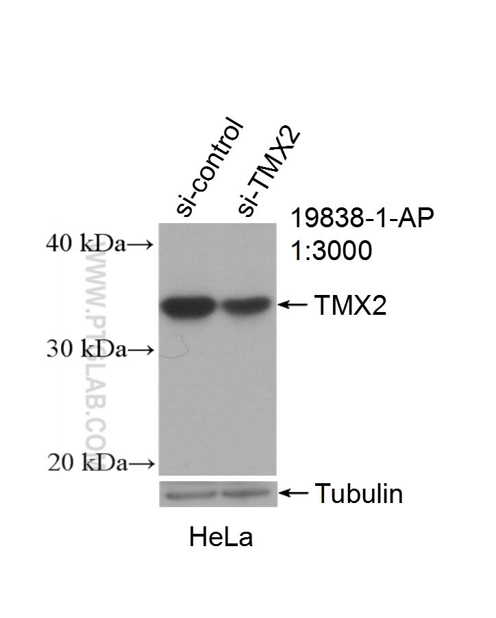 Western Blot (WB) analysis of HeLa cells using TMX2 Polyclonal antibody (19838-1-AP)