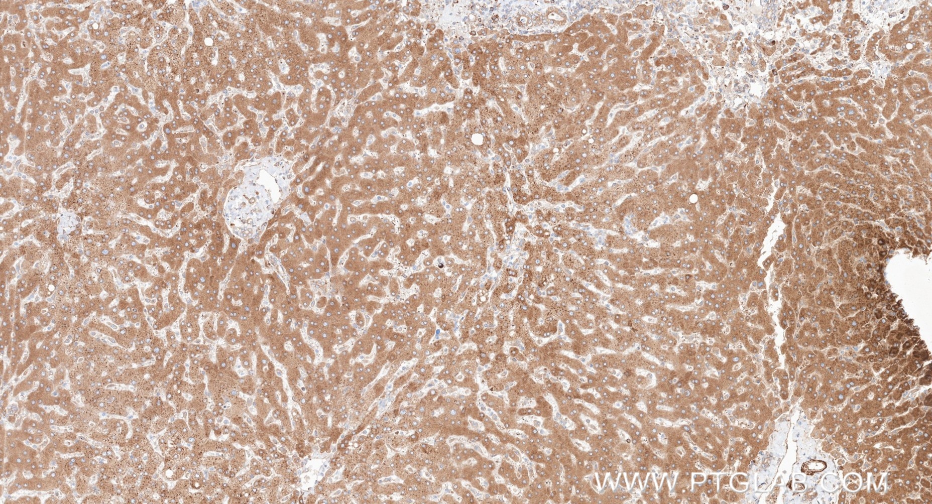 IHC staining of human liver using 87183-1-RR (same clone as 87183-1-PBS) Immunohistochemistry (IHC) staining of human liver tissue using TMX2 Recombinant monoclonal antibody (87183-1-RR)