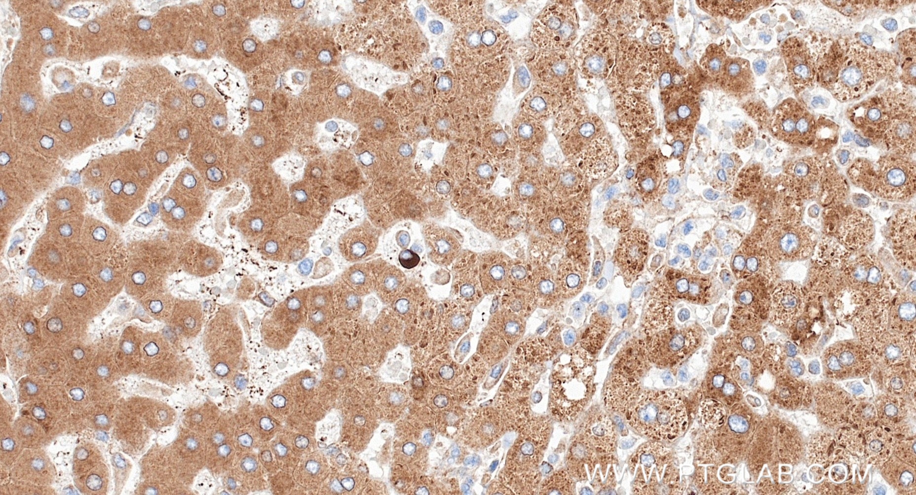 IHC staining of human liver using 87183-1-RR (same clone as 87183-1-PBS) Immunohistochemistry (IHC) staining of human liver tissue using TMX2 Recombinant monoclonal antibody (87183-1-RR)
