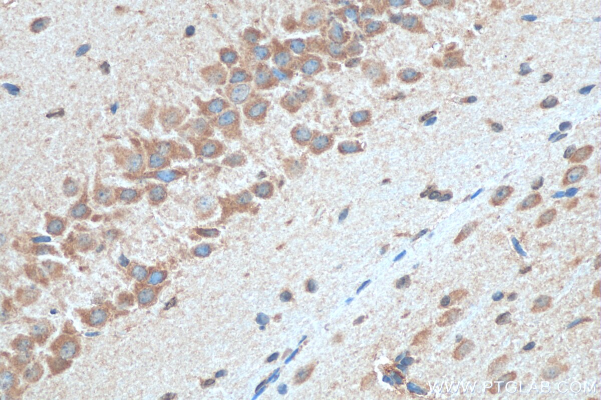 Immunohistochemistry (IHC) staining of mouse brain tissue using TMX3 Polyclonal antibody (21040-1-AP)