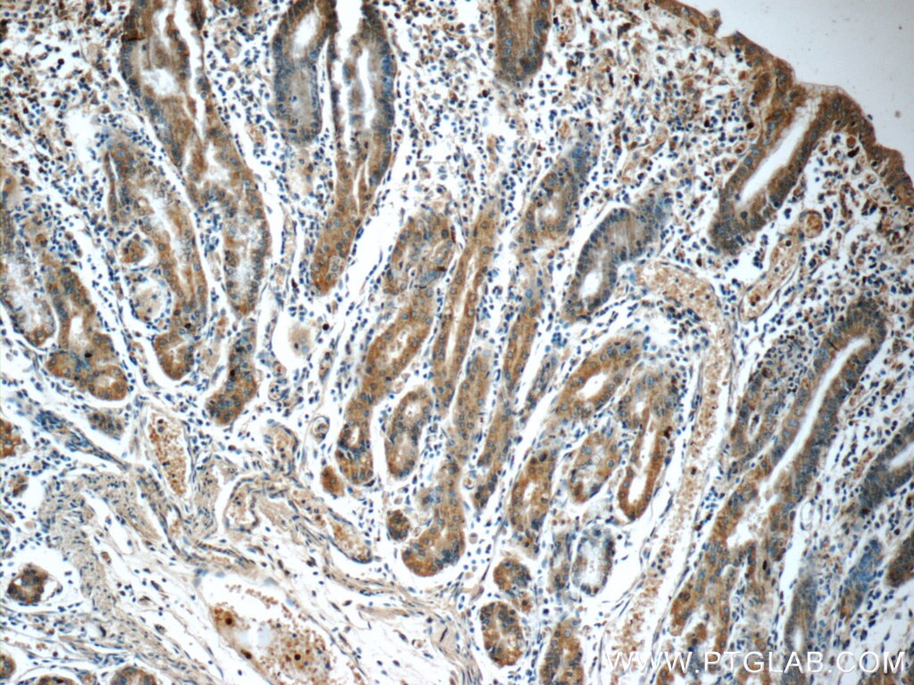 Immunohistochemistry (IHC) staining of human stomach tissue using TMX3 Polyclonal antibody (21040-1-AP)
