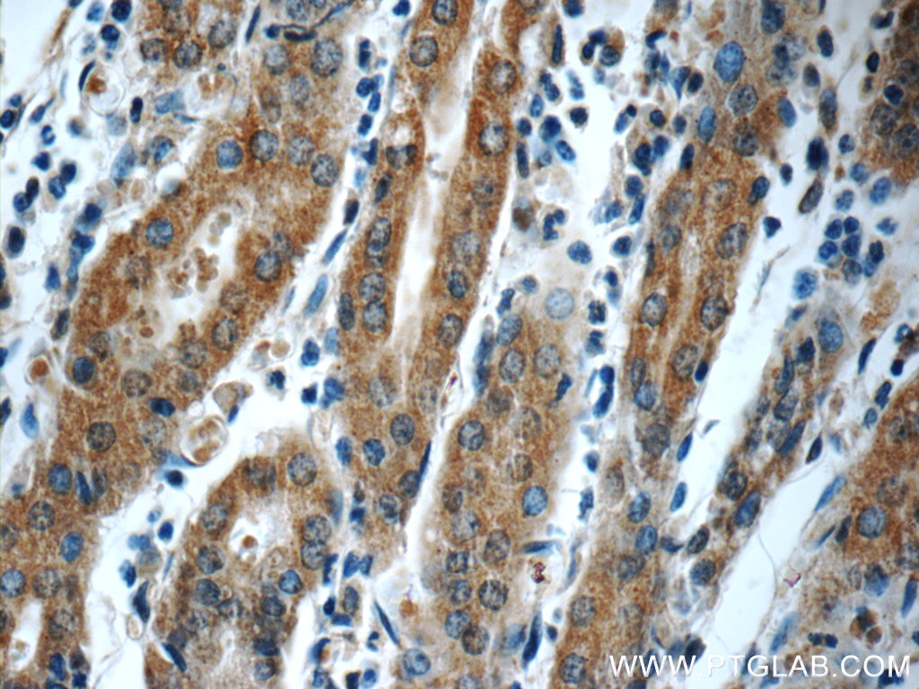 Immunohistochemistry (IHC) staining of human stomach tissue using TMX3 Polyclonal antibody (21040-1-AP)