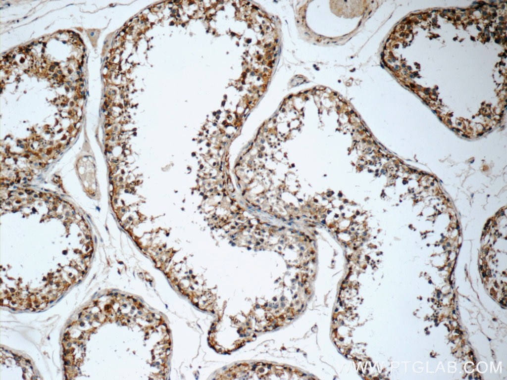 Immunohistochemistry (IHC) staining of human testis tissue using TMX3 Polyclonal antibody (21040-1-AP)