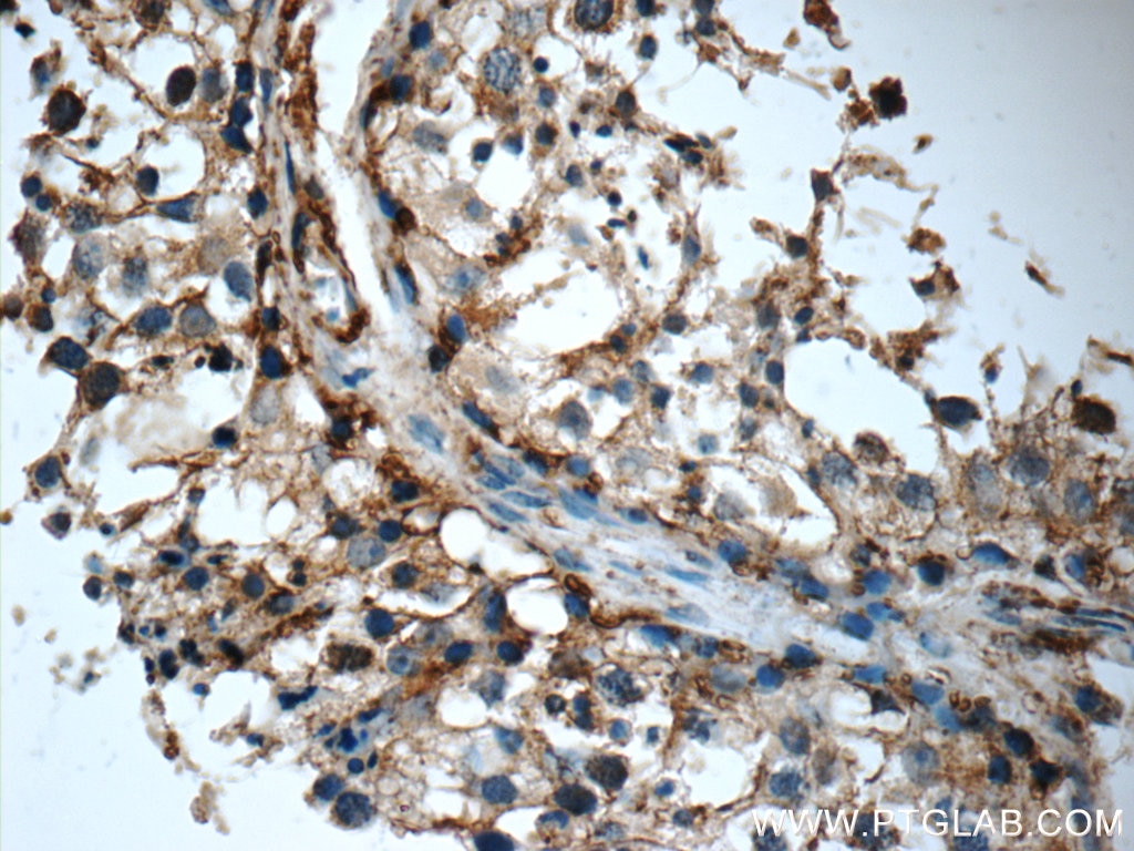 Immunohistochemistry (IHC) staining of human testis tissue using TMX3 Polyclonal antibody (21040-1-AP)