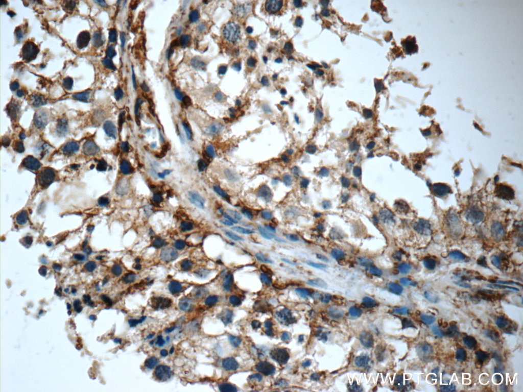 IHC staining of human testis using 21040-1-AP