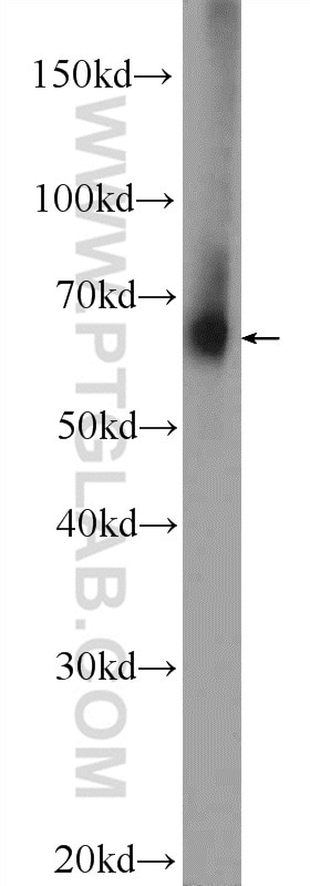 Western Blot (WB) analysis of mouse brain tissue using TMX3 Polyclonal antibody (21040-1-AP)