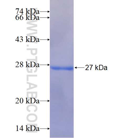 TMX3 fusion protein Ag15622 SDS-PAGE