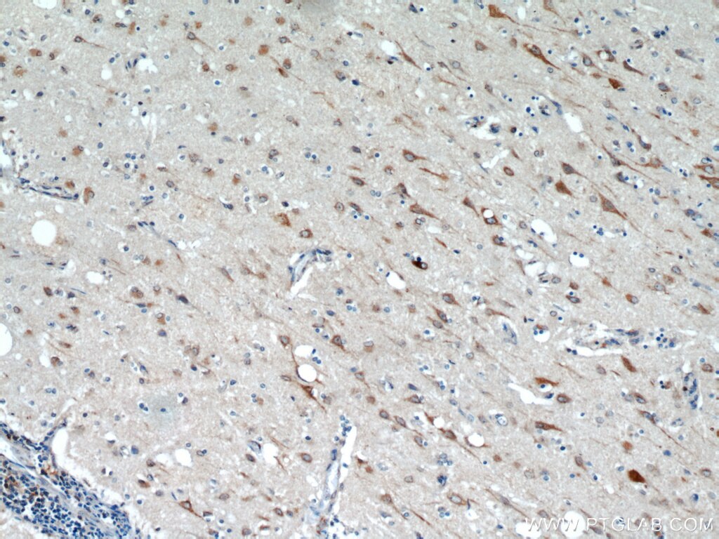 Immunohistochemistry (IHC) staining of human brain tissue using TMX4 Polyclonal antibody (21348-1-AP)