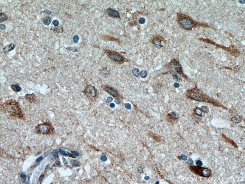 Immunohistochemistry (IHC) staining of human brain tissue using TMX4 Polyclonal antibody (21348-1-AP)