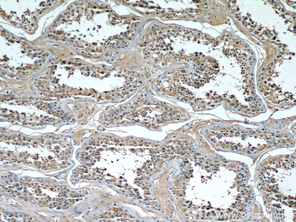 Immunohistochemistry (IHC) staining of human testis tissue using TMX4 Polyclonal antibody (21348-1-AP)