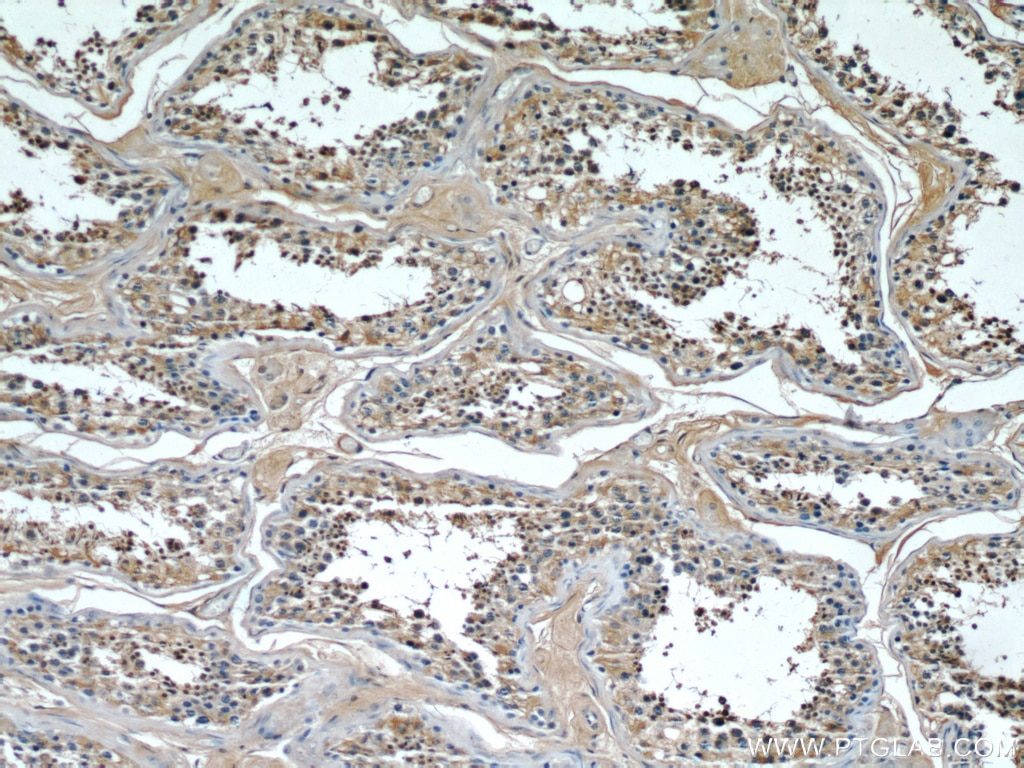 Immunohistochemistry (IHC) staining of human testis tissue using TMX4 Polyclonal antibody (21348-1-AP)