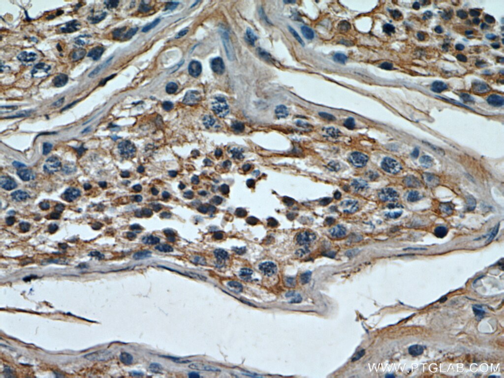 Immunohistochemistry (IHC) staining of human testis tissue using TMX4 Polyclonal antibody (21348-1-AP)