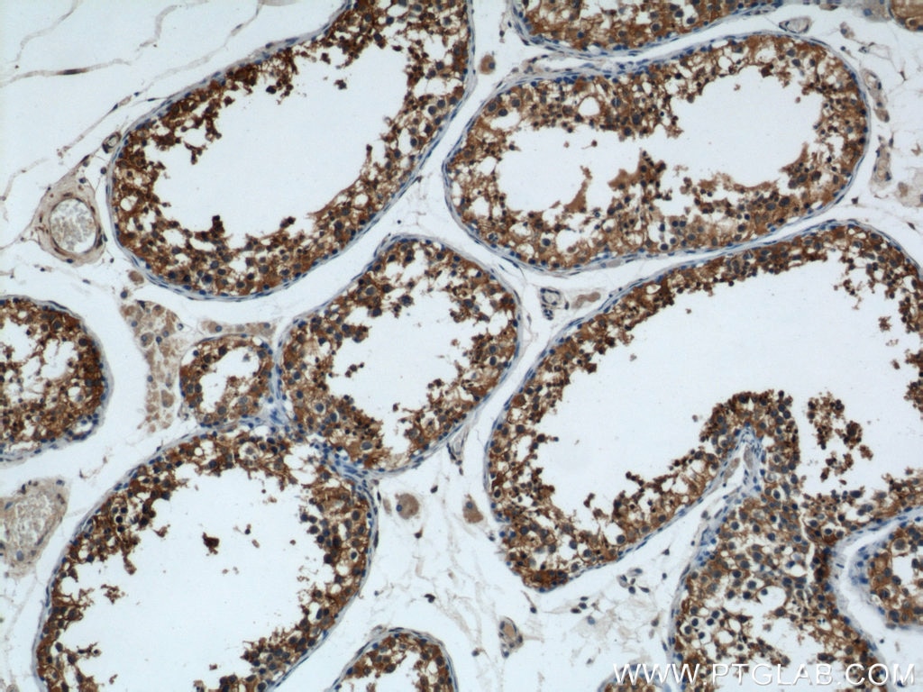 Immunohistochemistry (IHC) staining of human testis tissue using TMX4 Polyclonal antibody (21348-1-AP)