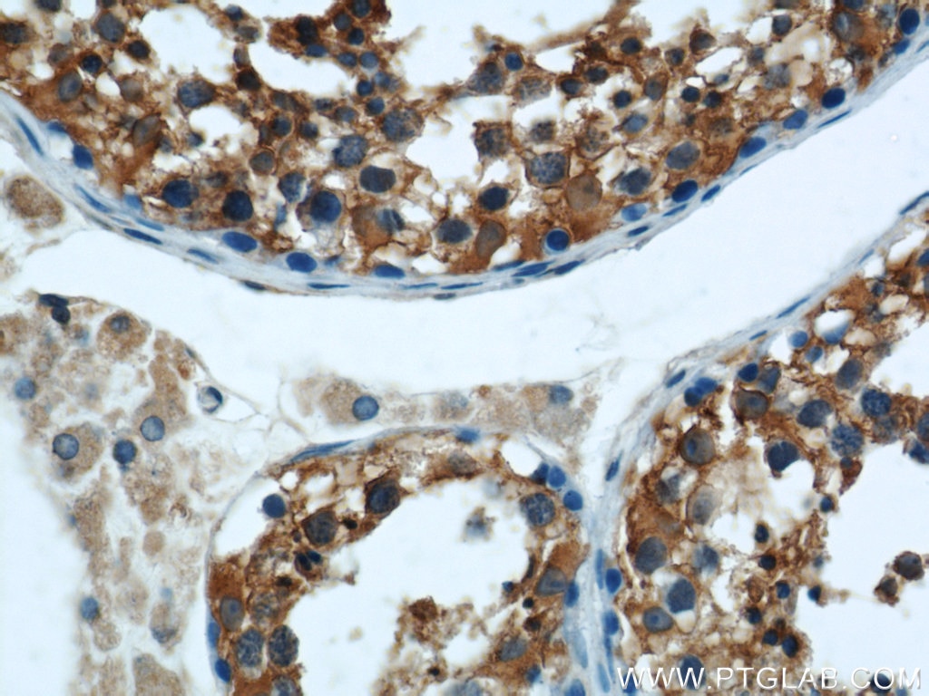 IHC staining of human testis using 21348-1-AP