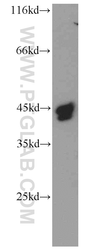 Western Blot (WB) analysis of A375 cells using TMX4 Polyclonal antibody (21348-1-AP)