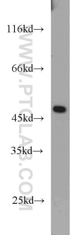 Western Blot (WB) analysis of mouse brain tissue using TMX4 Polyclonal antibody (21348-1-AP)