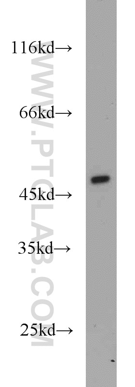 Western Blot (WB) analysis of mouse brain tissue using TMX4 Polyclonal antibody (21348-1-AP)