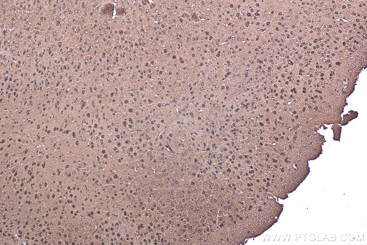 Immunohistochemistry (IHC) staining of mouse brain tissue using TNC/Tenascin-C Monoclonal antibody (67710-1-Ig)