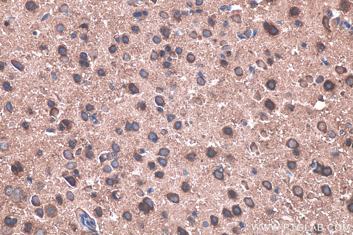 Immunohistochemistry (IHC) staining of mouse brain tissue using TNC/Tenascin-C Monoclonal antibody (67710-1-Ig)