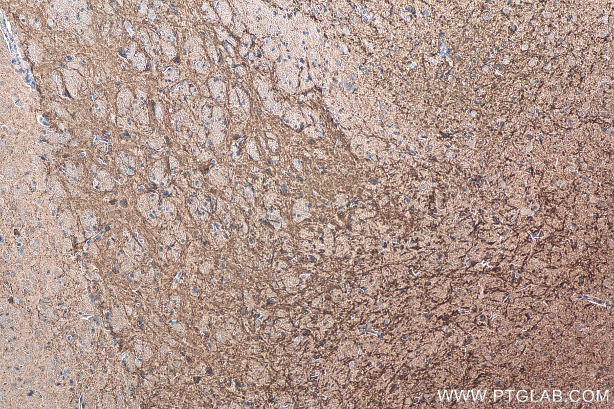 Immunohistochemistry (IHC) staining of rat brain tissue using TNC/Tenascin-C Monoclonal antibody (67710-1-Ig)