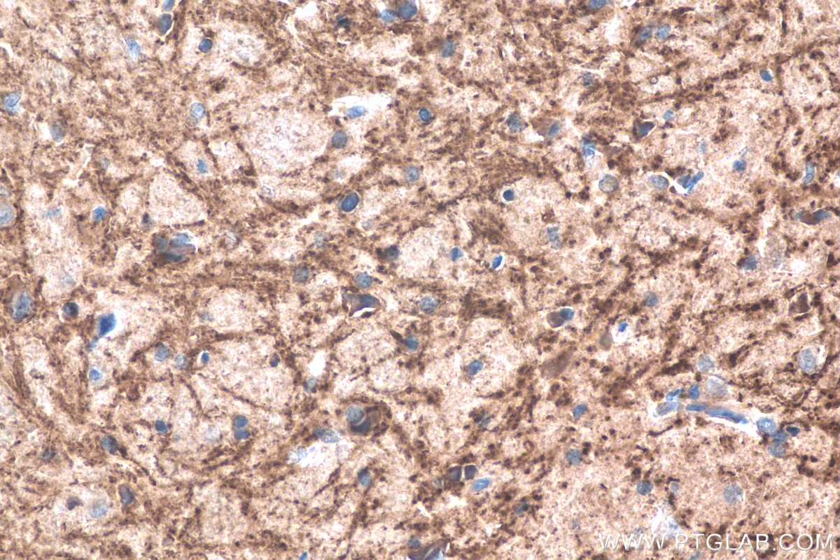 Immunohistochemistry (IHC) staining of rat brain tissue using TNC/Tenascin-C Monoclonal antibody (67710-1-Ig)