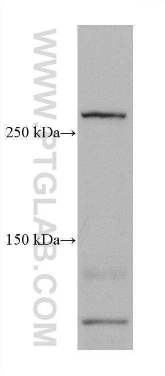 Western Blot (WB) analysis of HEK-293 cells using TNC/Tenascin-C Monoclonal antibody (67710-1-Ig)