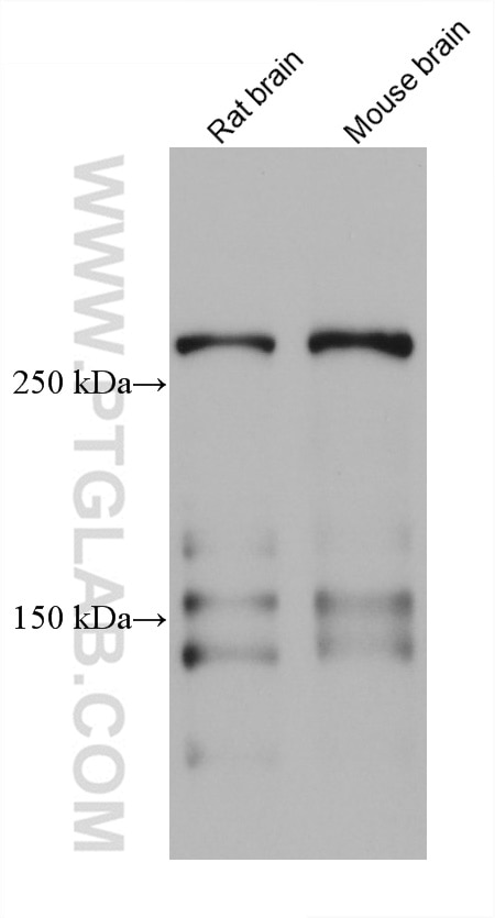 Western Blot (WB) analysis of various lysates using TNC/Tenascin-C Monoclonal antibody (67710-1-Ig)
