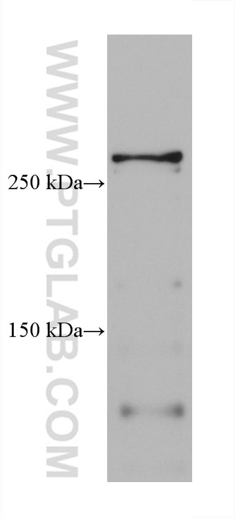 Western Blot (WB) analysis of rat cerebellum tissue using TNC/Tenascin-C Monoclonal antibody (67710-1-Ig)