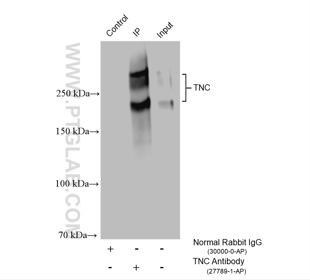 IP result of anti-TNC/Tenascin-C (IP:27789-1-AP, 4ug; Detection:27789-1-AP 1:3000) with U-87 MG cells lysate 1400 ug. Immunoprecipitation (IP) experiment of U-87 MG cells using TNC/Tenascin-C Polyclonal antibody (27789-1-AP)