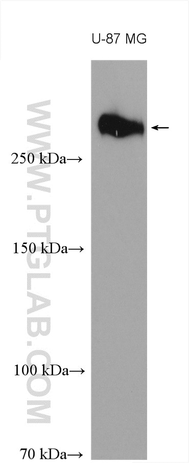 Western Blot (WB) analysis of various lysates using TNC/Tenascin-C Polyclonal antibody (27789-1-AP)