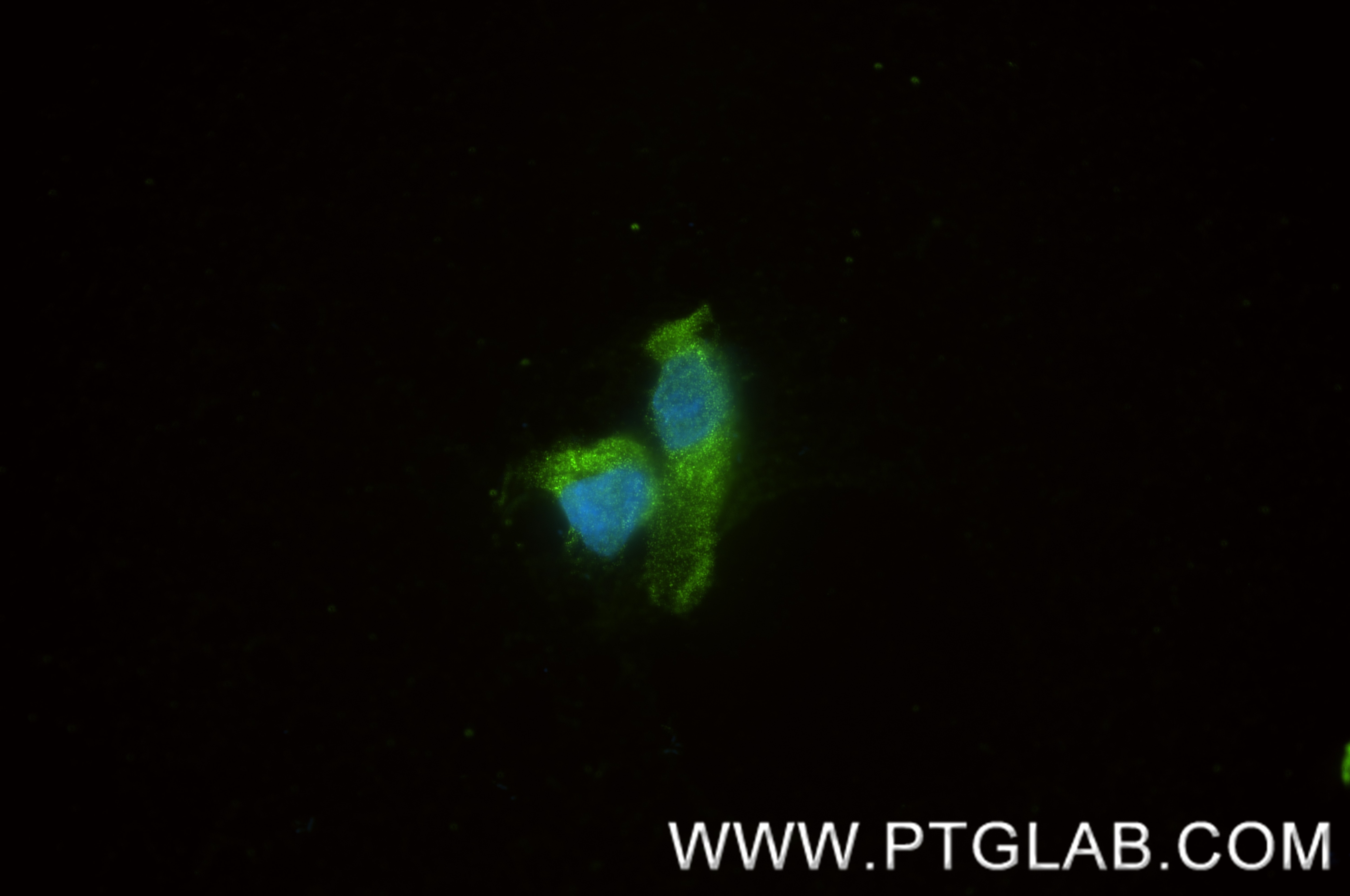 Immunofluorescence (IF) / fluorescent staining of HCT 116 cells using TNC/Tenascin-C Recombinant monoclonal antibody (83767-1-RR)