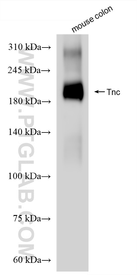 Western Blot (WB) analysis of mouse colon tissue using TNC/Tenascin-C Recombinant antibody (85821-1-RR)