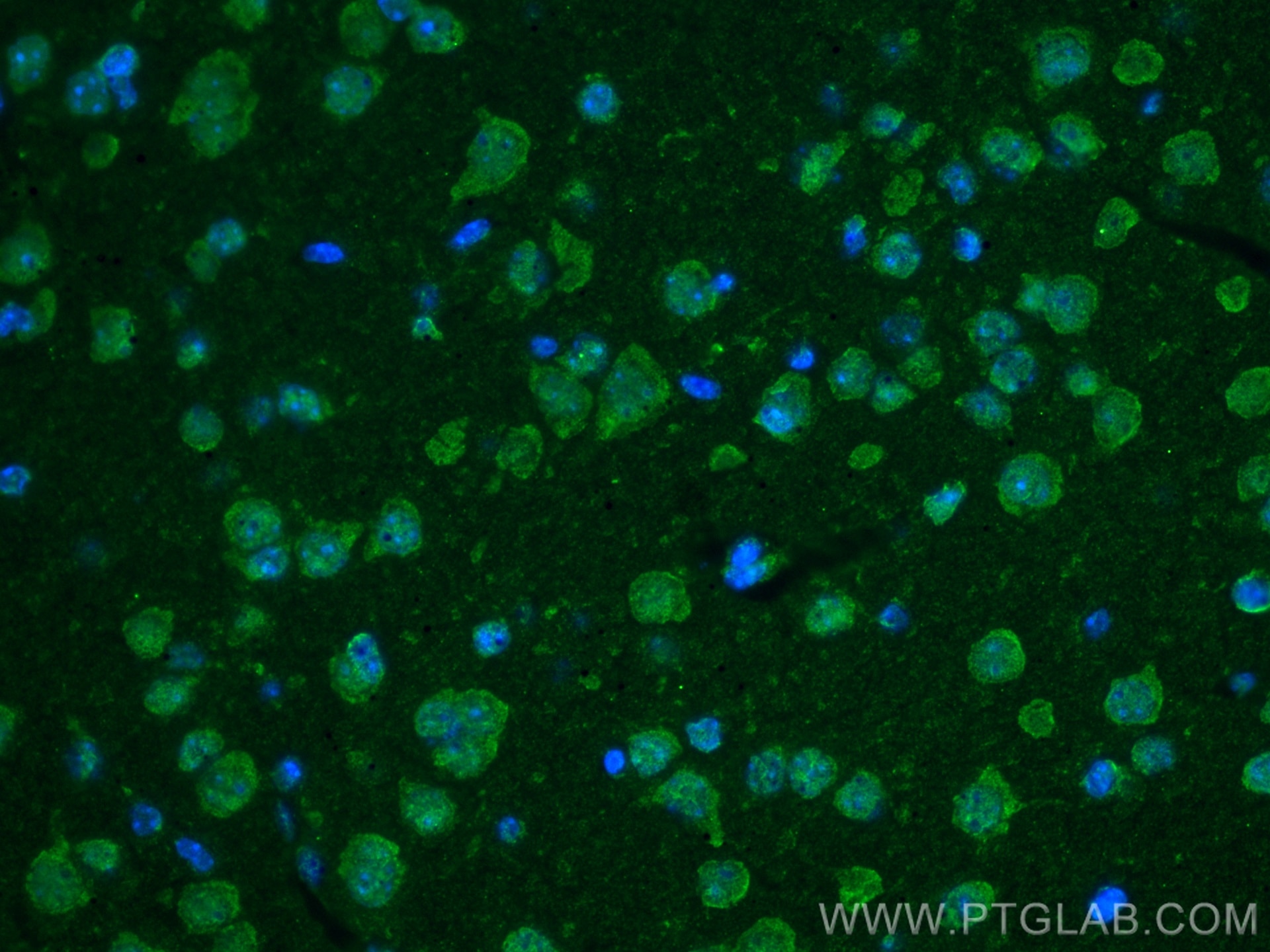 Immunofluorescence (IF) / fluorescent staining of mouse brain tissue using CoraLite® Plus 488-conjugated TNC/Tenascin-C Monoc (CL488-67710)