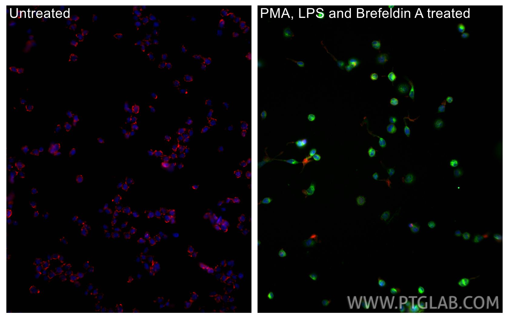 Immunofluorescence (IF) / fluorescent staining of THP-1 cells using CoraLite® Plus 488-conjugated TNF Alpha Polyclonal (CL488-17590)