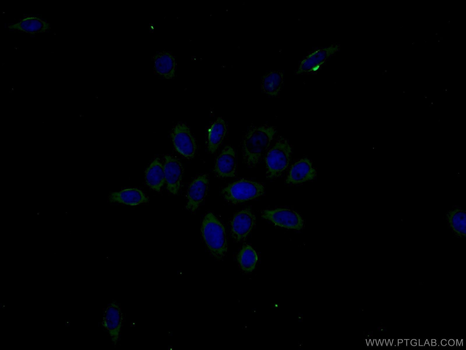 TNF Alpha Monoclonal antibody