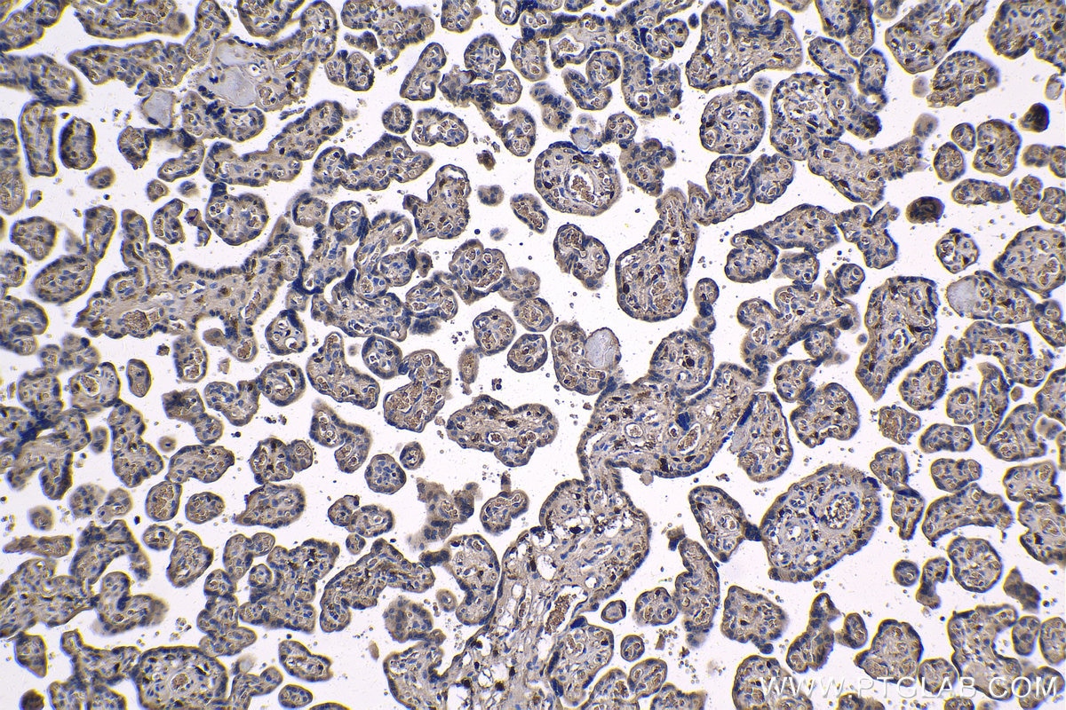 Immunohistochemistry (IHC) staining of human placenta tissue using TNF-alpha Monoclonal antibody (60291-1-Ig)