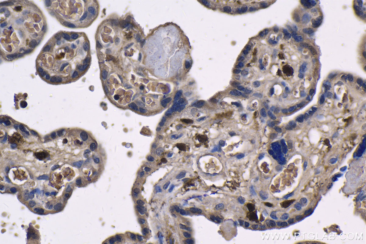 Immunohistochemistry (IHC) staining of human placenta tissue using TNF-alpha Monoclonal antibody (60291-1-Ig)