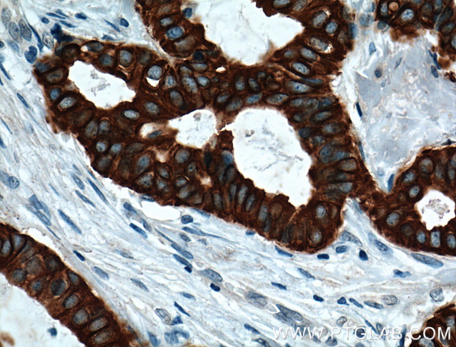 TNF Alpha Monoclonal antibody