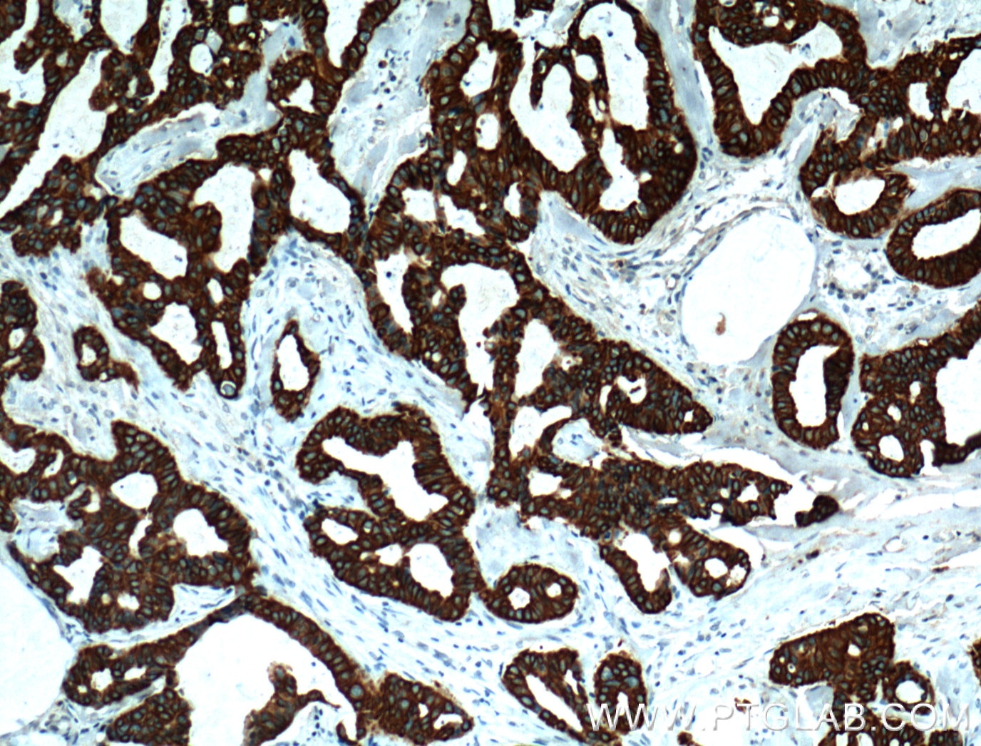 TNF Alpha Monoclonal antibody