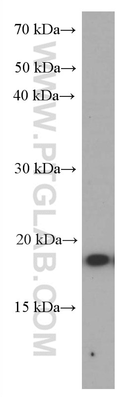 TNF Alpha Monoclonal antibody