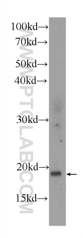 TNF Alpha Monoclonal antibody