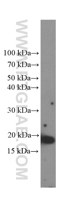 TNF Alpha Monoclonal antibody