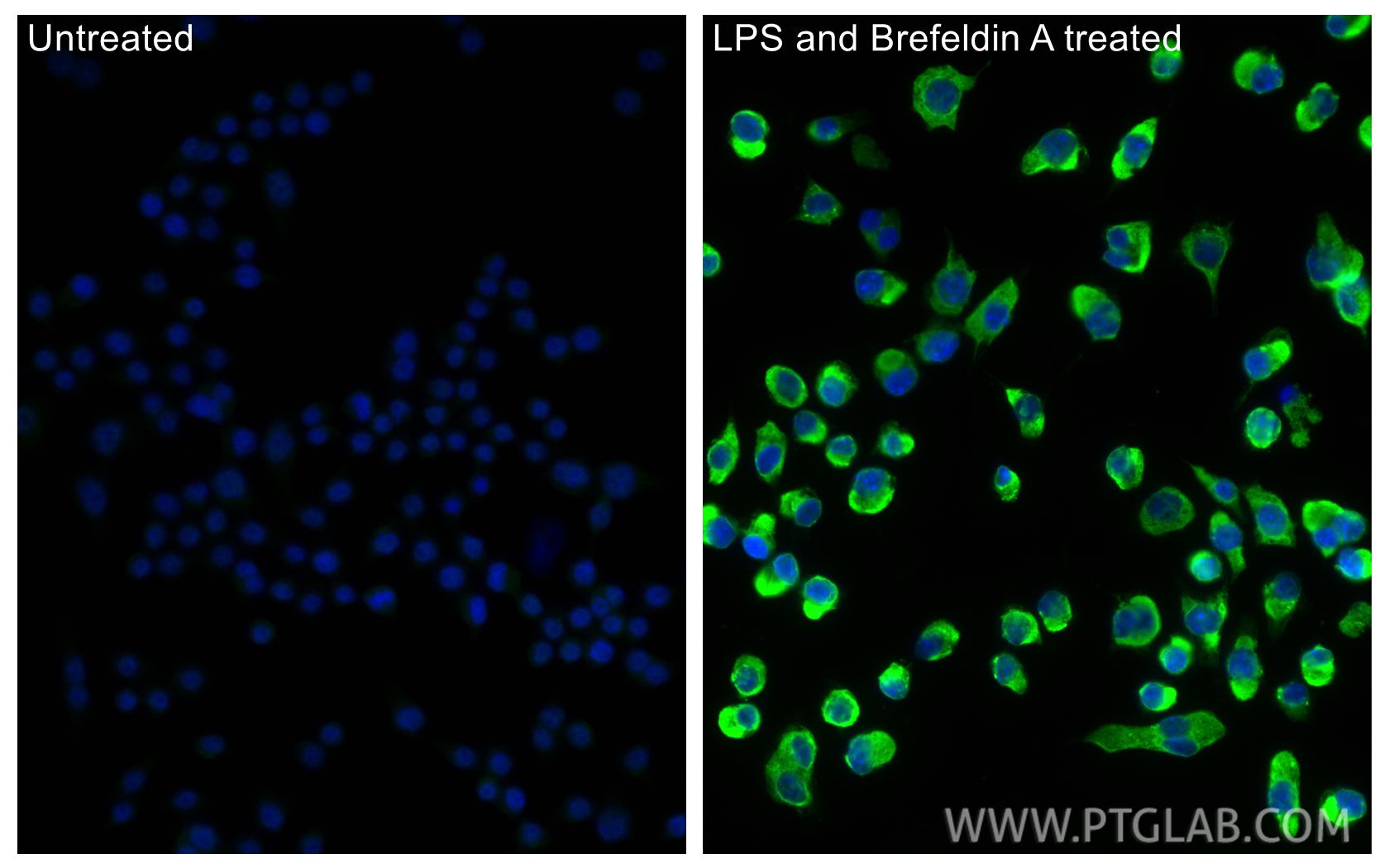 Immunofluorescence (IF) / fluorescent staining of RAW 264.7 cells using TNF-alpha Polyclonal antibody (26162-1-AP)
