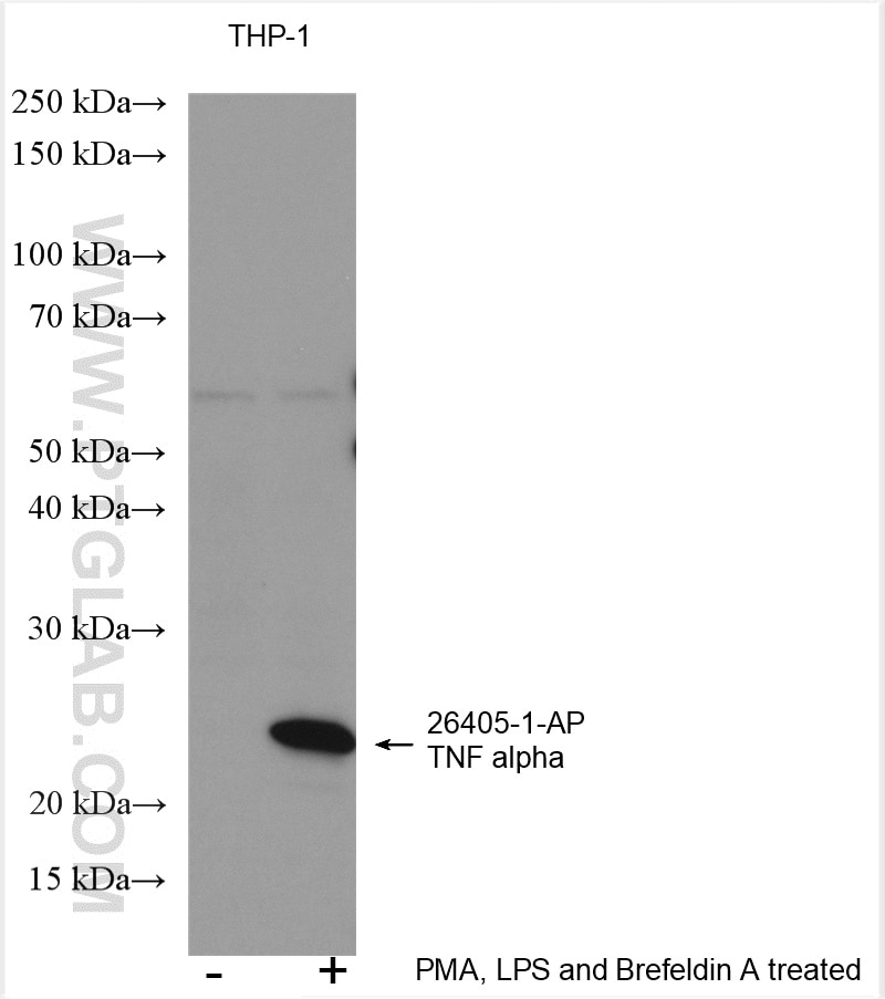 Western Blot (WB) analysis of various lysates using TNF Alpha Polyclonal antibody (26405-1-AP)